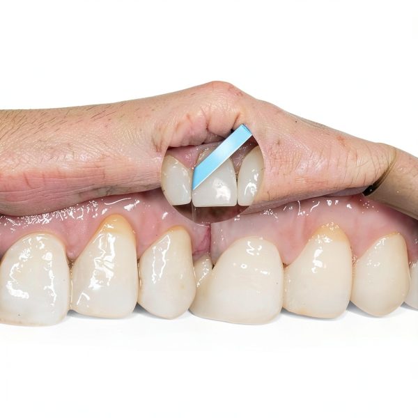 Dental Polishing Strips Fine Grit 30um by NatureAqua 4mmx6m Blue Roll-2